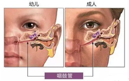 【听力科普】儿童听力保健小知识(图3)