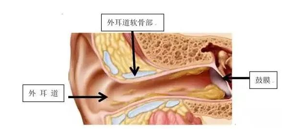 【听力科普】从零开始的日常听力保健(外耳篇)(图5) 【听力科普】从零开始的日常听力保健(外耳篇)(图5)