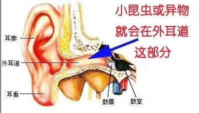 【听力科普】从零开始的日常听力保健(外耳篇)(图7) 【听力科普】从零开始的日常听力保健(外耳篇)(图7)